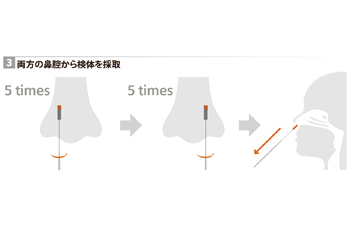 操作手順03