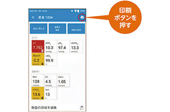 操作手順05